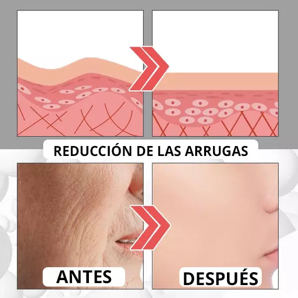 BOTOX PREMIUM™ - Serum Rejuvenecimiento Facial instantaneo✨